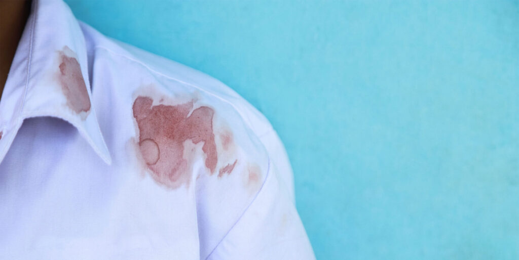 Blood stained shirt of a man who was assaulted