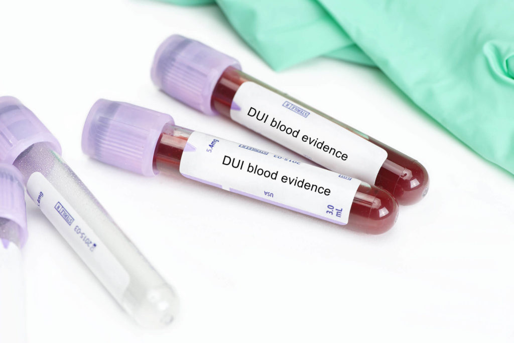 Vial of blood for DUI testing